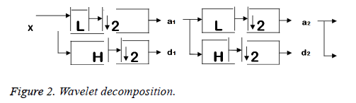 biomedres-Wavelet-decomposition