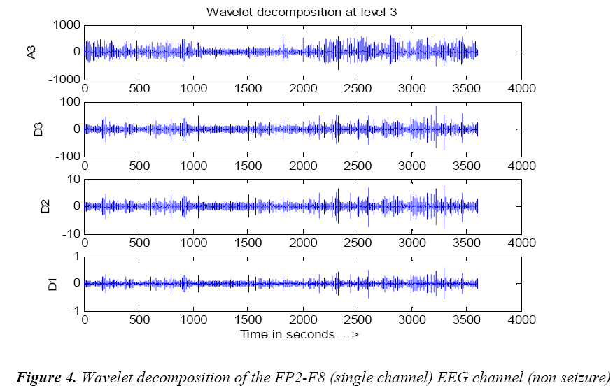 biomedres-Wavelet-decomposition-channel