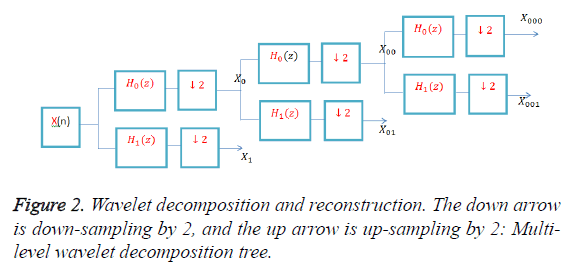 biomedres-Wavelet-decomposition-reconstruction