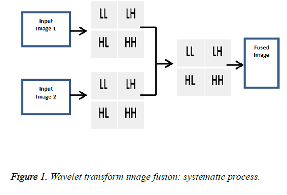 biomedres-Wavelet-transform