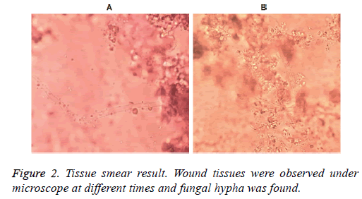 biomedres-Wound-tissues