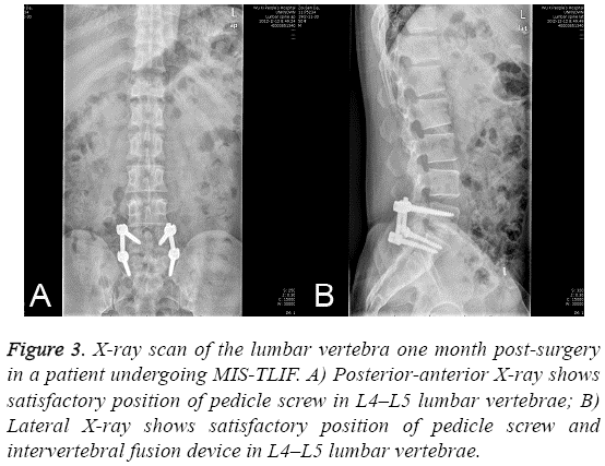 biomedres-X-ray-scan