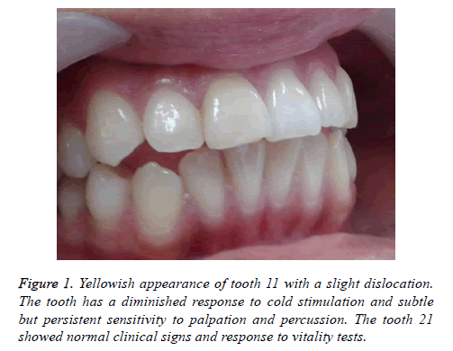 biomedres-Yellowish-appearance