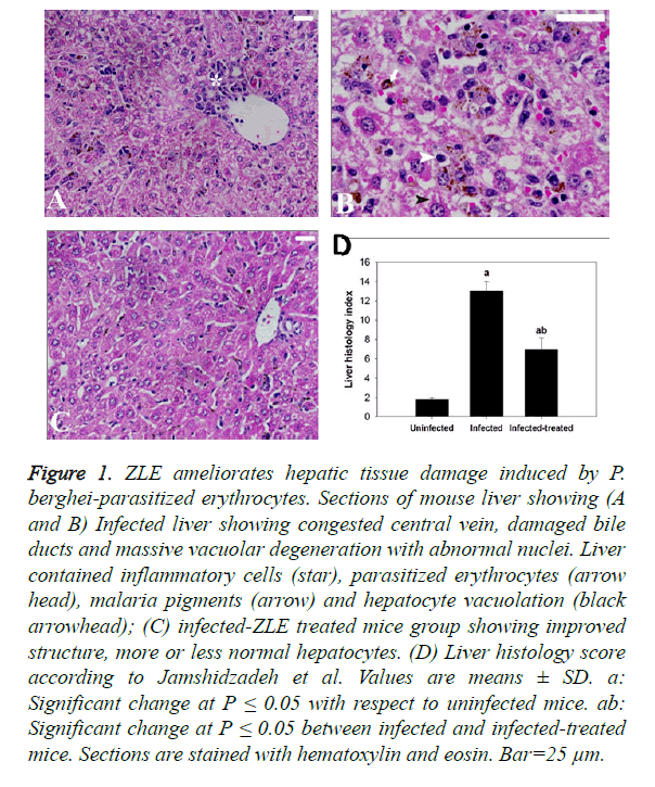 biomedres-ZLE-ameliorates-hepatic