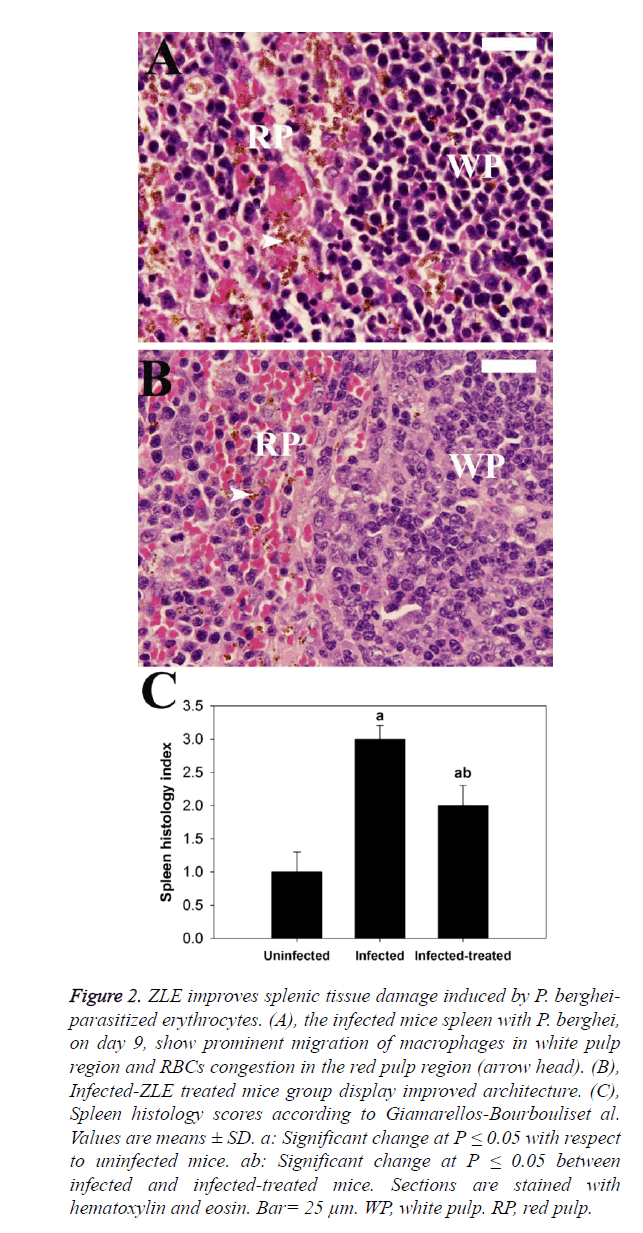 biomedres-ZLE-improves-splenic