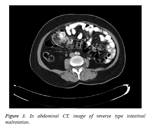 biomedres-abdominal-CT