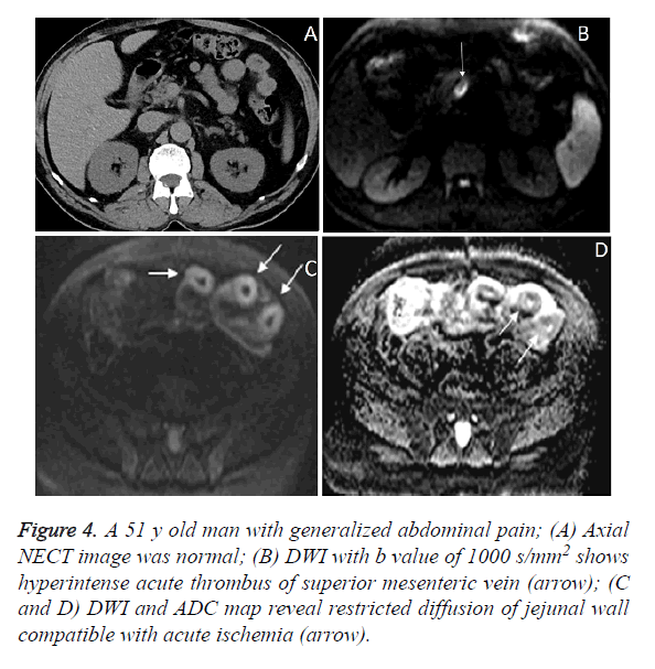 biomedres-abdominal-pain