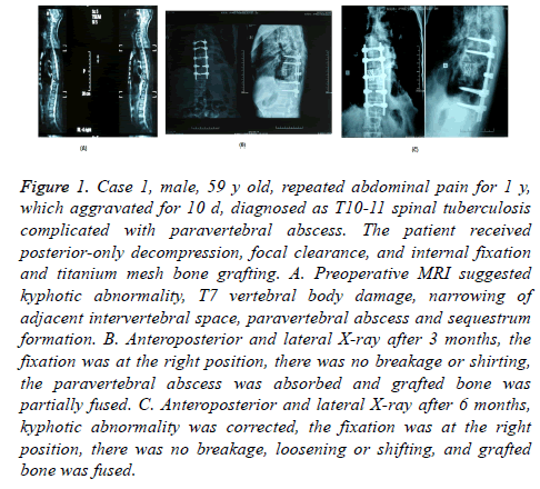 biomedres-abdominal-pain