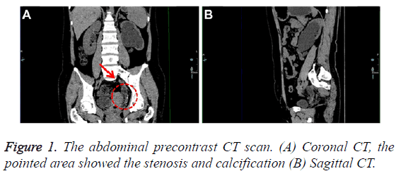 biomedres-abdominal-precontrast