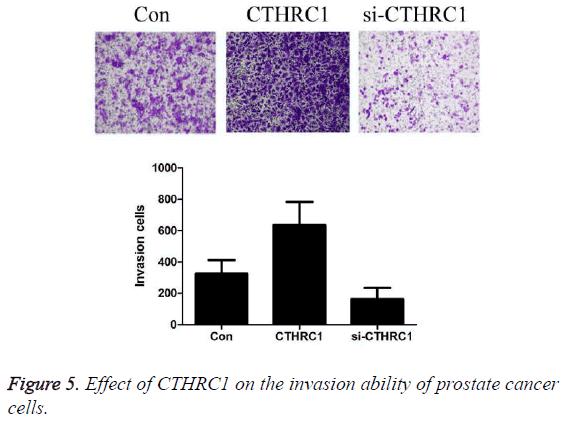 biomedres-ability-prostate-cancer