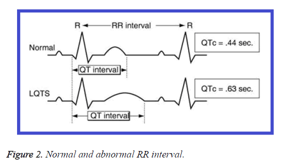 biomedres-abnormal-RR