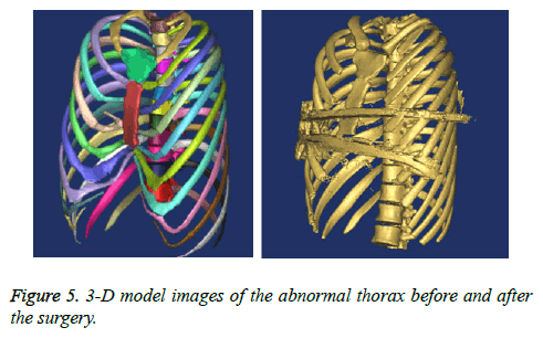 biomedres-abnormal-thorax