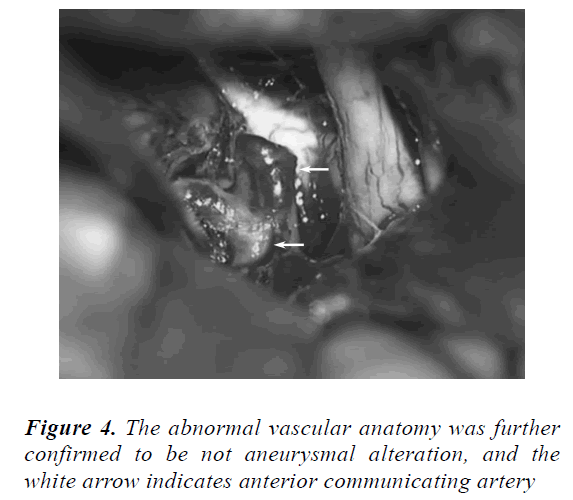 biomedres-abnormal-vascular