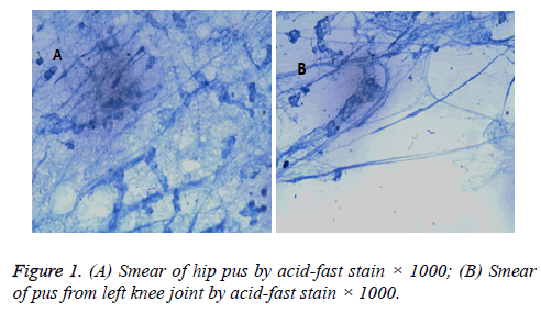 biomedres-acid-fast-stain