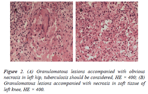 biomedres-acid-lesions