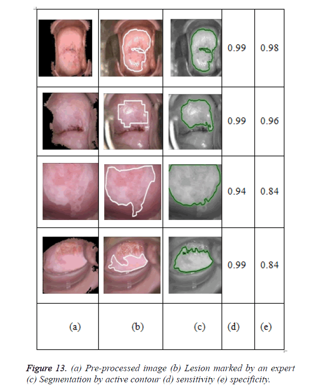 biomedres-active-contour