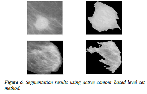 biomedres-active-contour