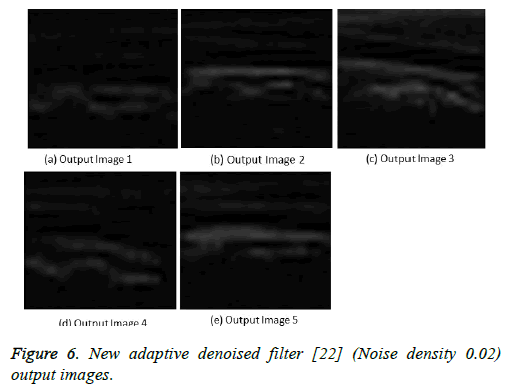 biomedres-adaptive-denoised