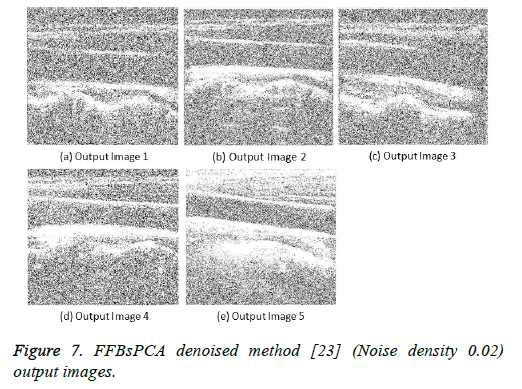 biomedres-adaptive-denoised