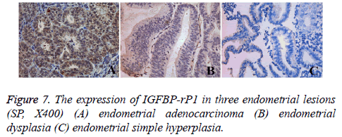 biomedres-adenocarcinoma