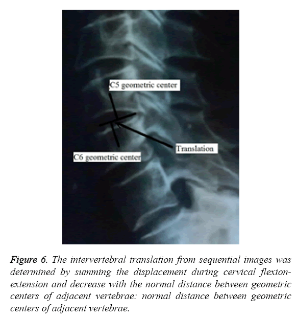 biomedres-adjacent-vertebrae