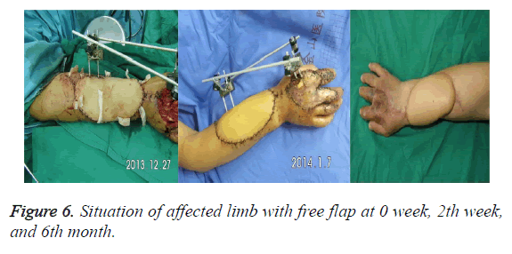 biomedres-affected-limb