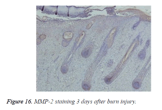 biomedres-after-burn