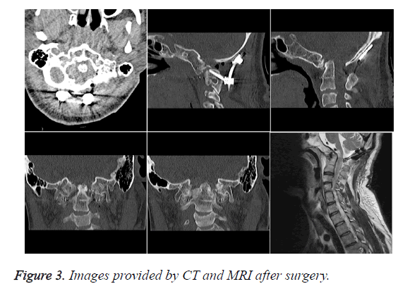 biomedres-after-surgery