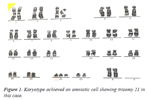 biomedres-amniotic-cell