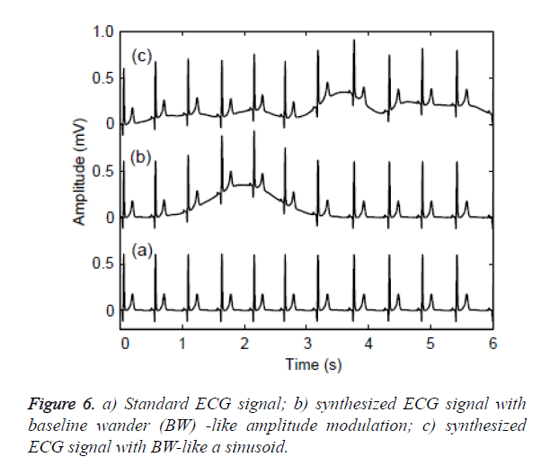 biomedres-amplitude-modulation