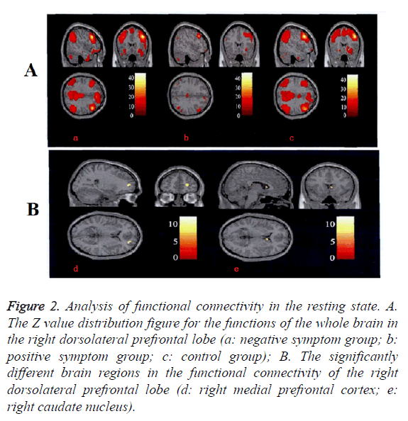 biomedres-analysis-functional-connectivity