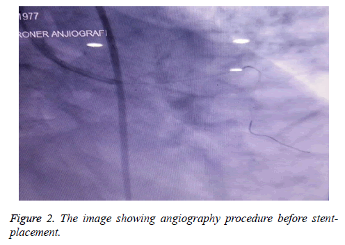 biomedres-angiography-procedure