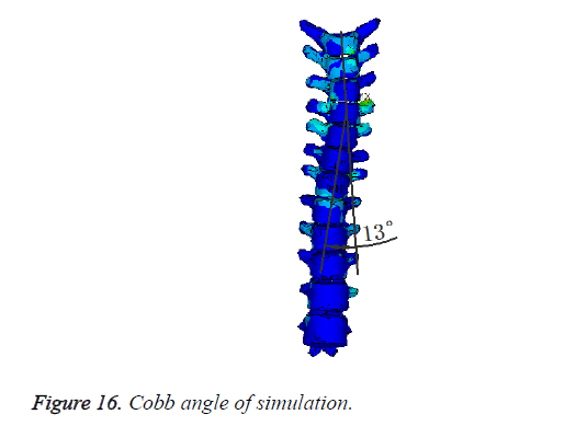 biomedres-angle-simulation