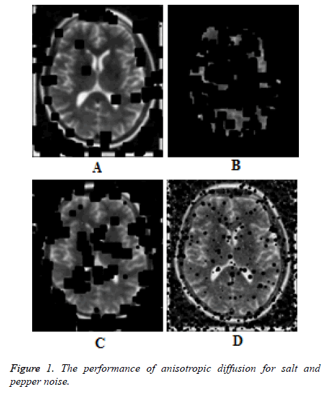 biomedres-anisotropic-diffusion