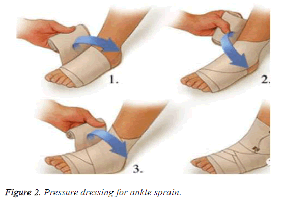 biomedres-ankle-sprain