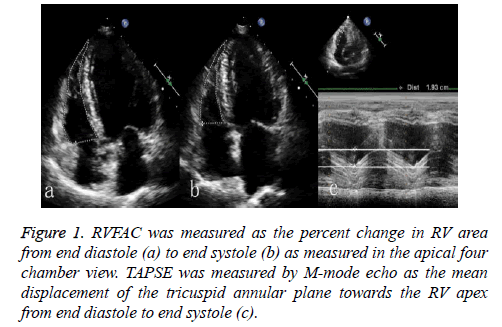 biomedres-annular-plane