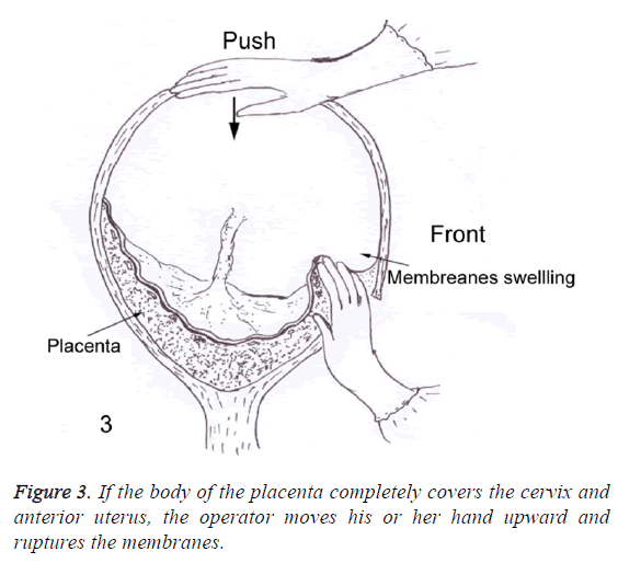 biomedres-anterior-uterus