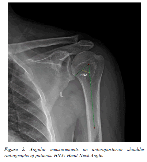 biomedres-anteroposterior-shoulder