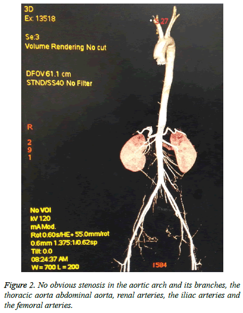 biomedres-aortic-arch