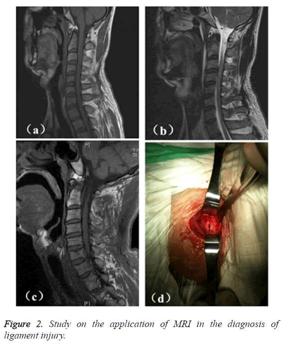 biomedres-application-MRI-diagnosis