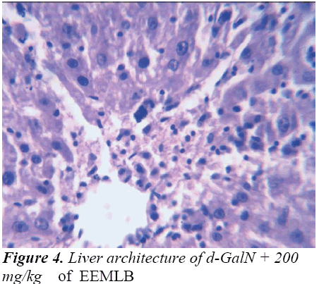 biomedres-architecture-EEMLB-GalN