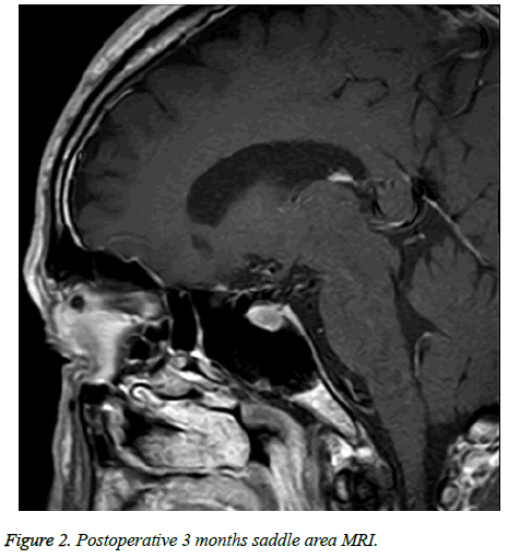 biomedres-area-MRI