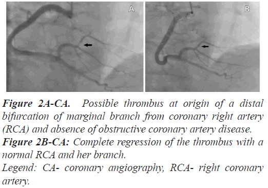 biomedres-artery-disease