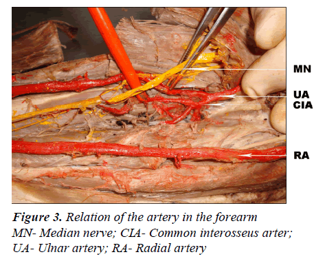 biomedres-artery-forearm-Median-interosseus