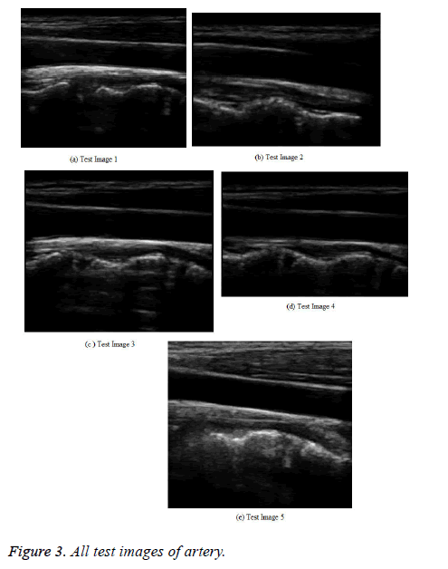 biomedres-denoised-filter