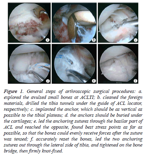 biomedres-arthroscopic-surgical-procedures