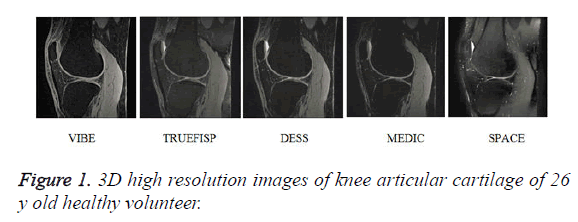 biomedres-articular-cartilage