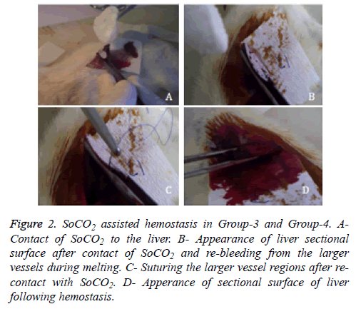 biomedres-assisted-hemostasis