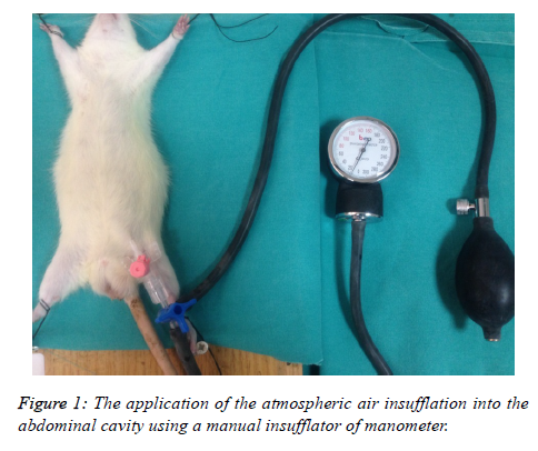 biomedres-atmospheric-air-insufflation