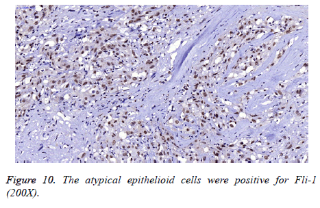 biomedres-atypical-cells